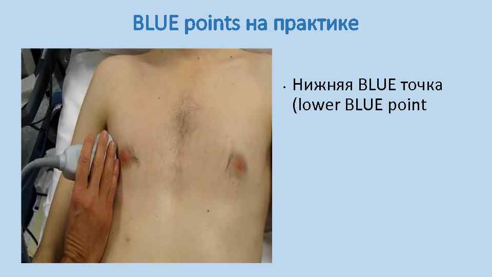 BLUE points на практике • Нижняя BLUE точка (lower BLUE point 