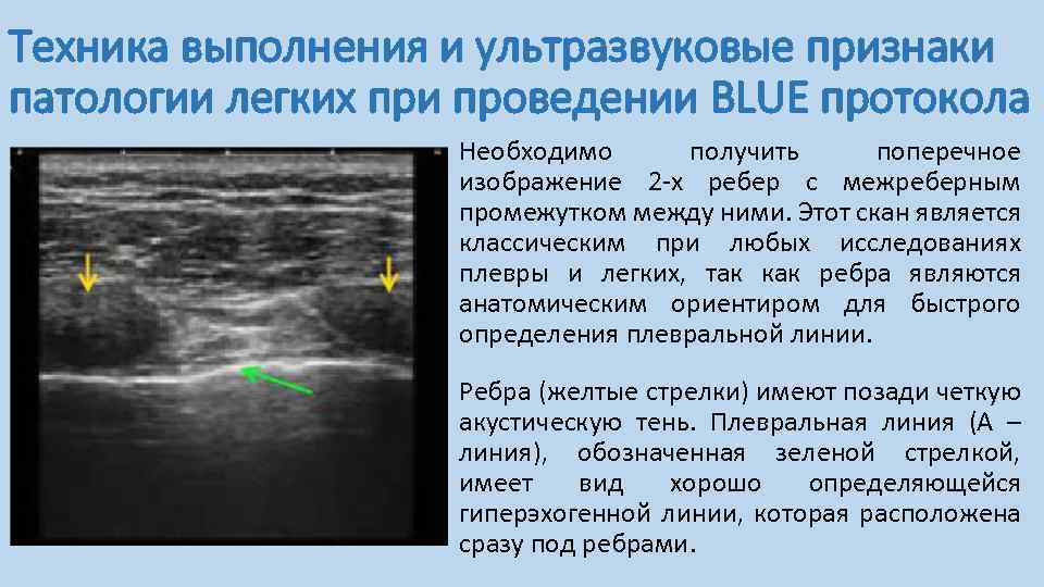 Ультразвуковое исследование презентация