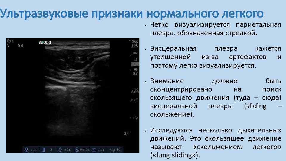 Протокол узи плевральных полостей образец