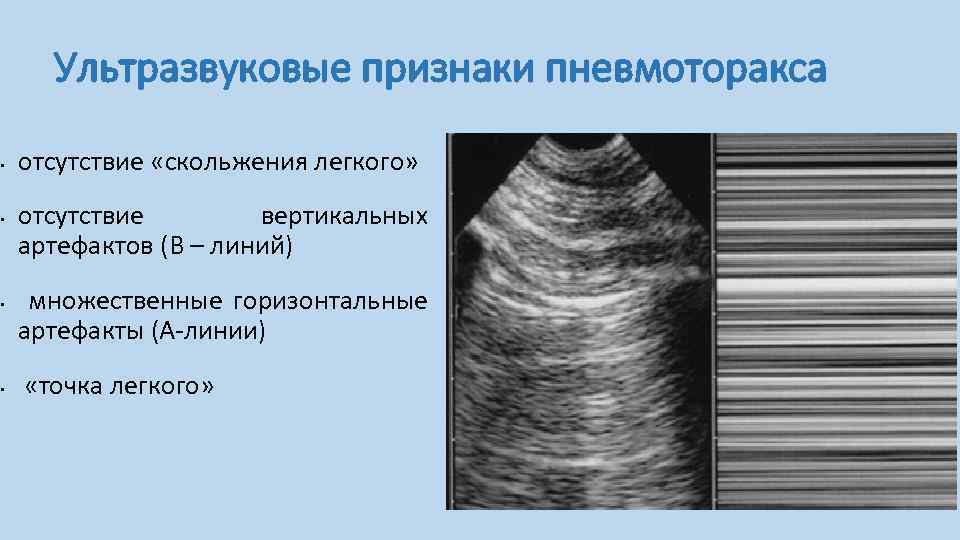 Ультразвуковое исследование в таблицах и схемах капустин