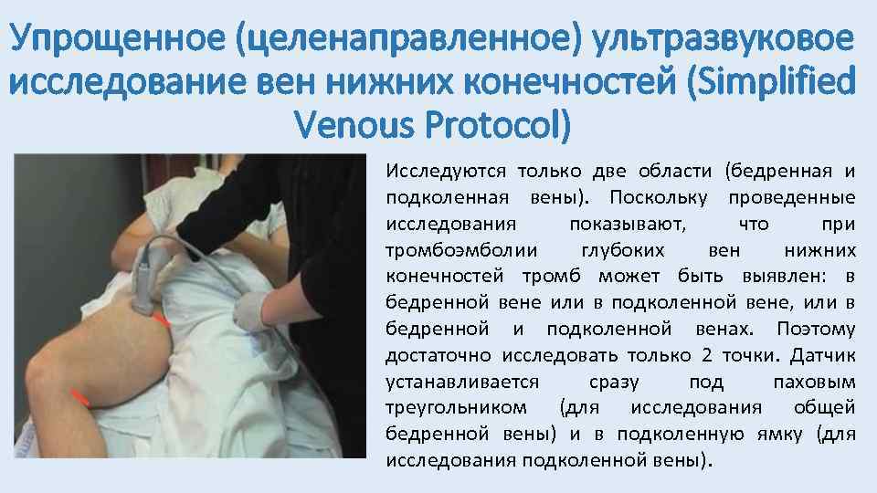Упрощенное (целенаправленное) ультразвуковое исследование вен нижних конечностей (Simplified Venous Protocol) Исследуются только две области