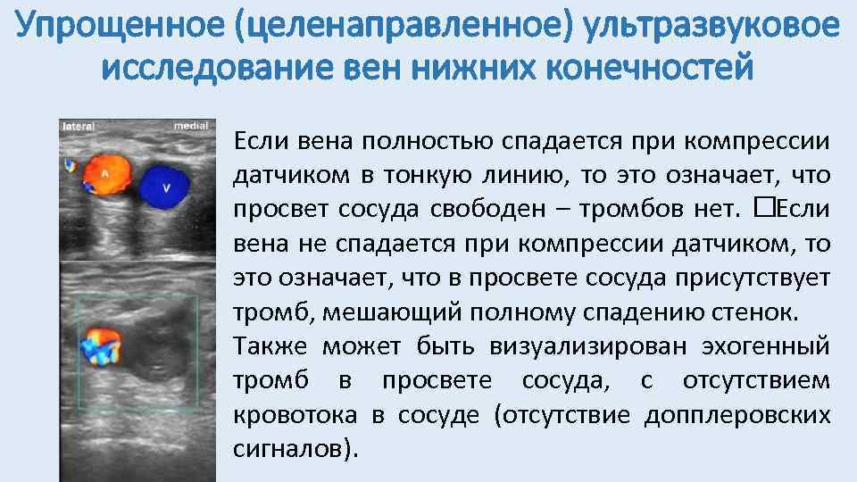 Исследование вен