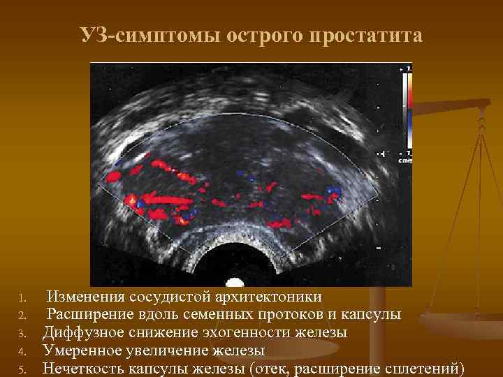 Простатит на фоне стресса