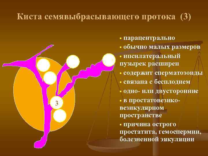 Киста семявыбрасывающего протока (3) парацентрально § обычно малых размеров § ипсилатеральный пузырек расширен §