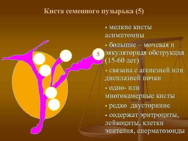 Киста семенного пузырька (5) мелкие кисты асимптомны § большие – мочевая и 5 эякуляторная