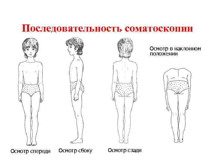Последовательность соматоскопии Осмотр в наклонном положении Осмотр спереди Осмотр сбоку Осмотр сзади 