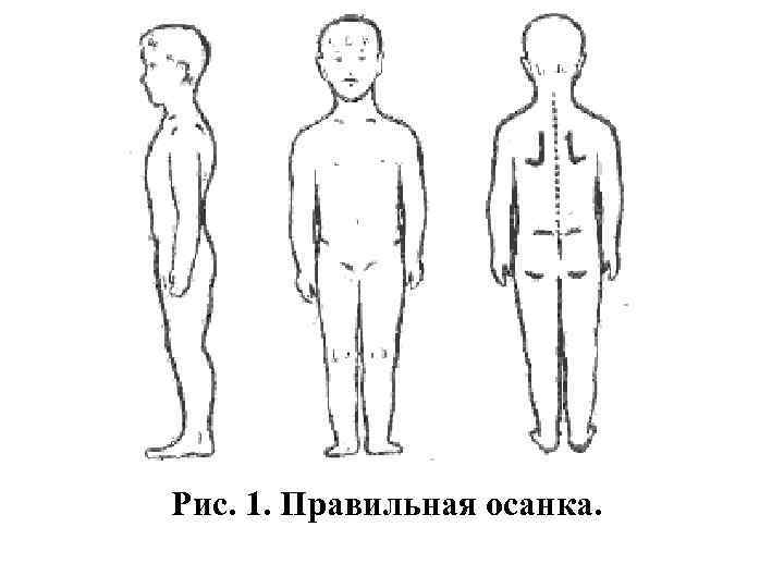 Рис. 1. Правильная осанка. 
