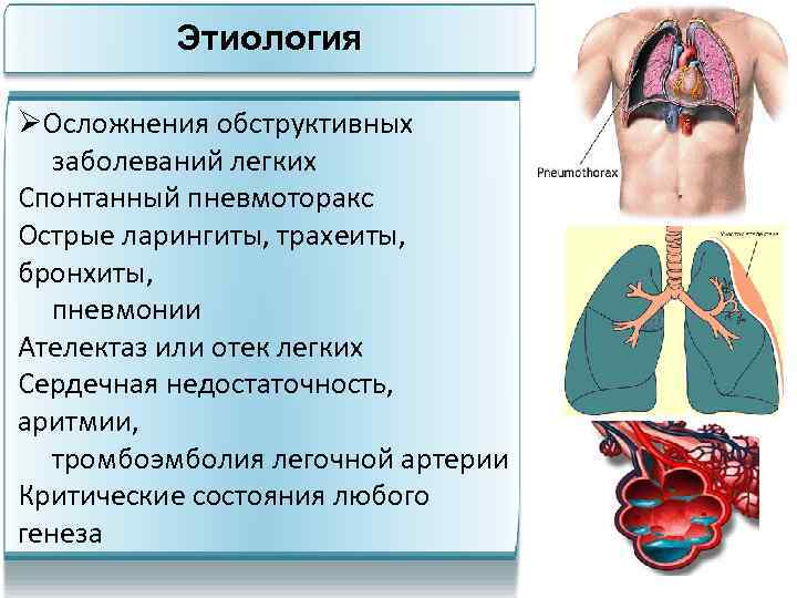 Этиология ØОсложнения обструктивных заболеваний легких Спонтанный пневмоторакс Острые ларингиты, трахеиты, бронхиты, пневмонии Ателектаз или