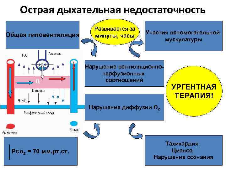 Острая дыхательная недостаточность Общая гиповентиляция Развивается за минуты, часы Участия вспомогательной мускулатуры Нарушение вентиляционноперфузионных