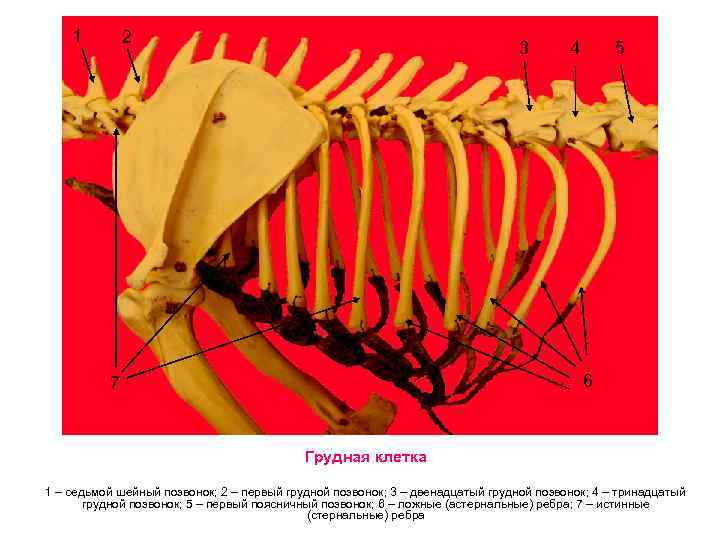 1 2 3 4 5 6 7 Грудная клетка 1 – седьмой шейный позвонок;