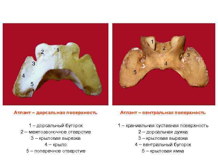 1 2 2 1 3 3 4 5 Атлант – дорсальная поверхность Атлант –