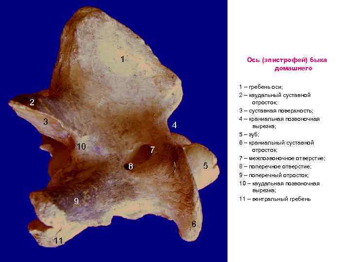 1 Ось (эпистрофей) быка домашнего 2 3 4 10 7 5 8 9 6