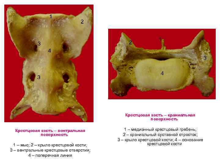 1 2 2 3 1 4 3 3 4 Крестцовая кость – краниальная поверхность