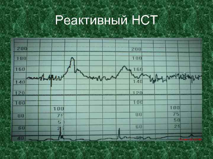 Реактивный НСТ 
