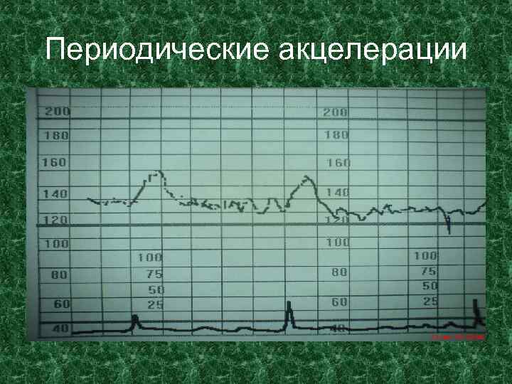 Периодические акцелерации 