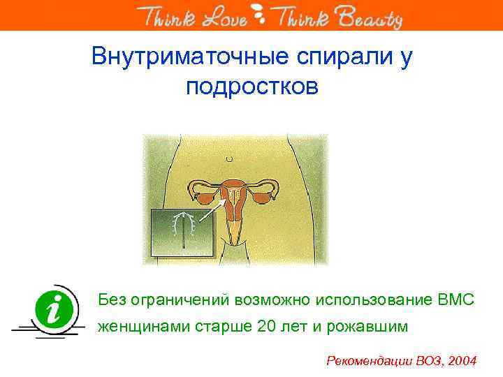 Внутриматочные спирали у подростков Без ограничений возможно использование ВМС женщинами старше 20 лет и