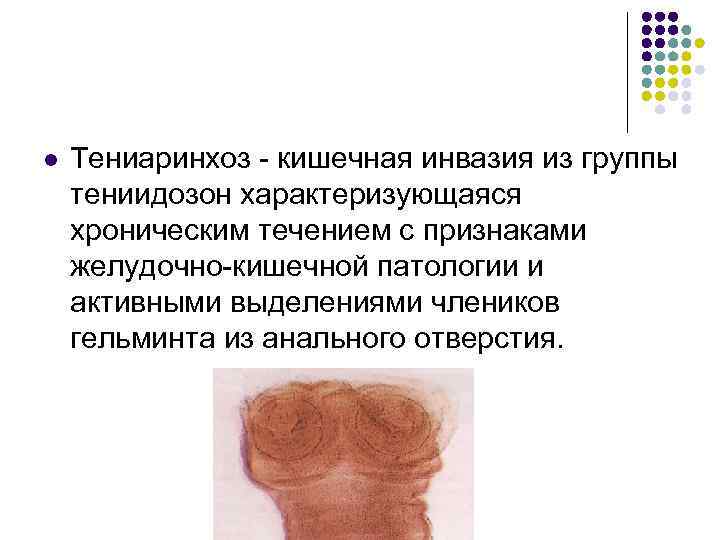 l Тениаринхоз - кишечная инвазия из группы тениидозон характеризующаяся хроническим течением с признаками желудочно-кишечной