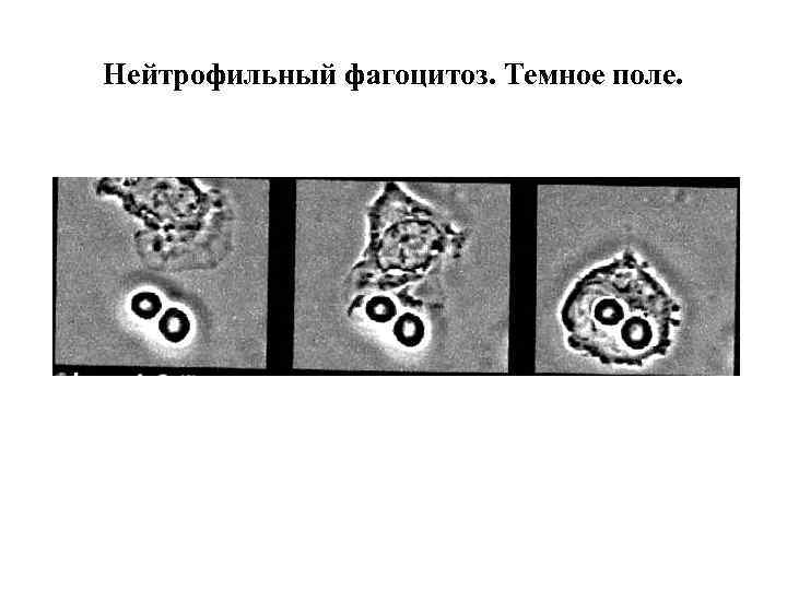 Нейтрофильный фагоцитоз. Темное поле. 