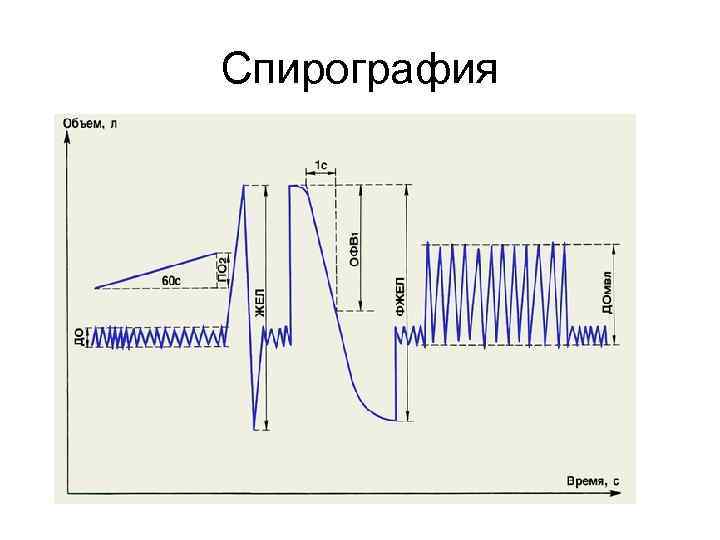Спирография 
