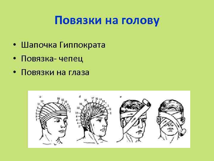 Повязки на голову • Шапочка Гиппократа • Повязка- чепец • Повязки на глаза 