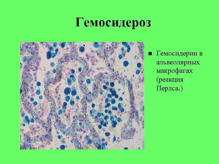 Реакция перлса