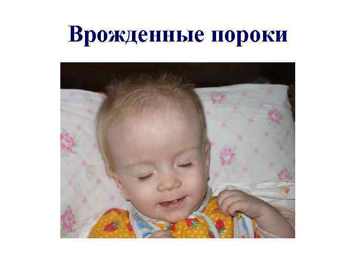 Врожденные пороки 