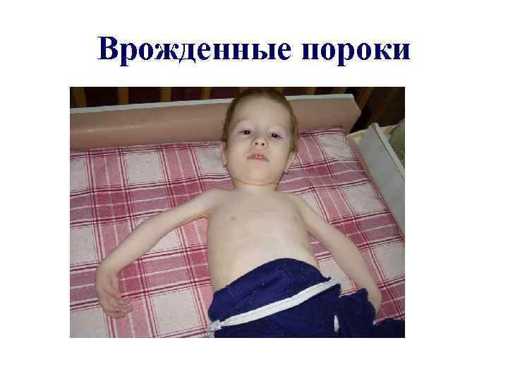 Врожденные пороки 