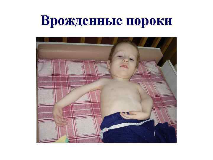 Врожденные пороки 