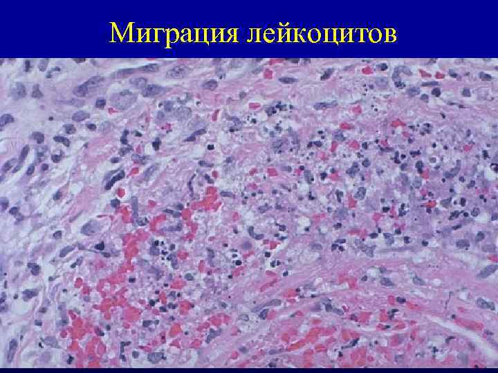 Миграция лейкоцитов 