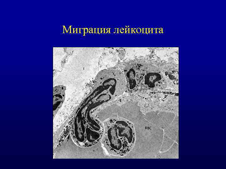 Миграция лейкоцита 