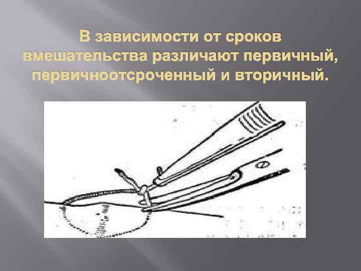 В зависимости от сроков вмешательства различают первичный, первичноотсроченный и вторичный. 