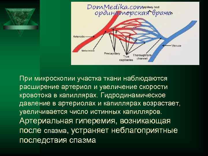 При микроскопии участка ткани наблюдаются расширение артериол и увеличение скорости кровотока в капиллярах. Гидродинамическое