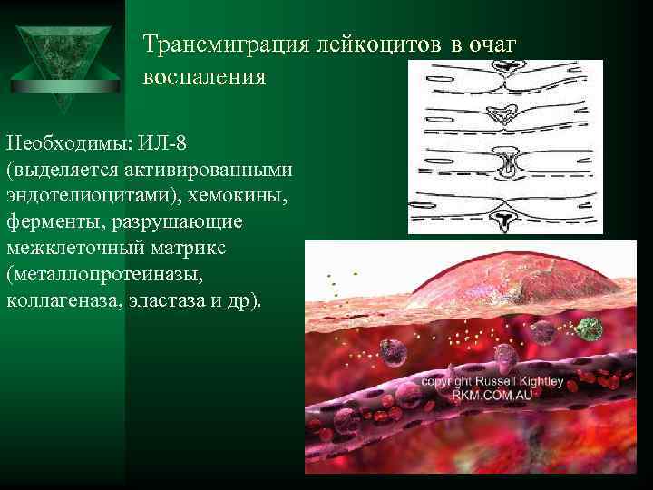  Трансмиграция лейкоцитов в очаг воспаления Необходимы: ИЛ-8 (выделяется активированными эндотелиоцитами), хемокины, ферменты, разрушающие