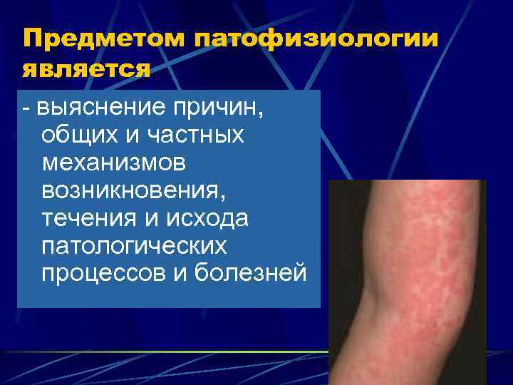 Предметом патофизиологии является - выяснение причин, общих и частных механизмов возникновения, течения и исхода