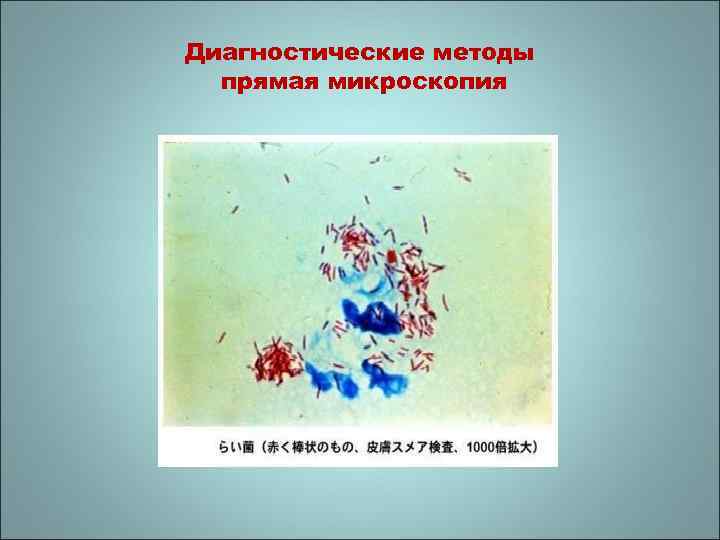 Диагностические методы прямая микроскопия 