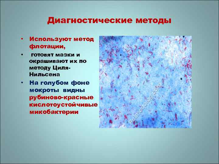 Диагностические методы • Используют метод флотации, • готовят мазки и окрашивают их по методу