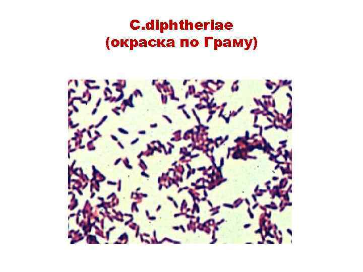C. diphtheriae (окраска по Граму) 