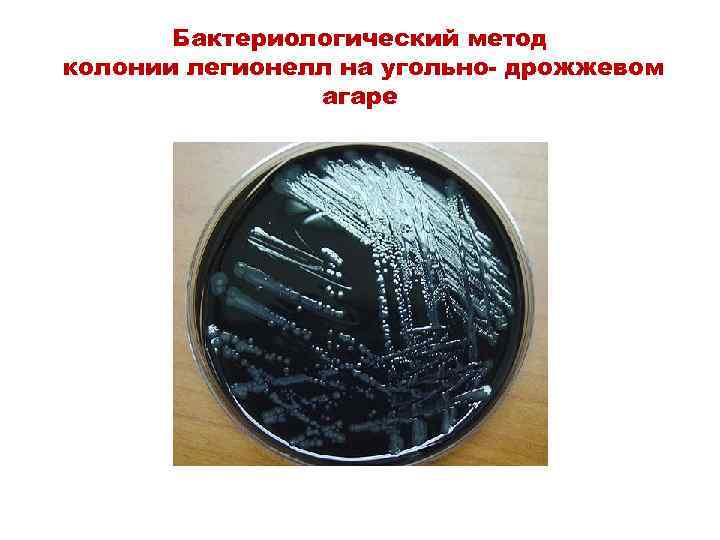 Бактериологический метод колонии легионелл на угольно- дрожжевом агаре 