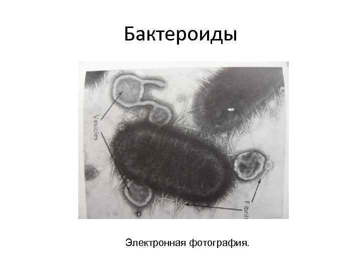 Бактероиды Электронная фотография. 