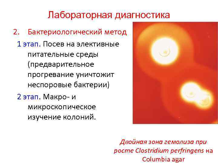 Лабораторная диагностика 2. Бактериологический метод 1 этап. Посев на элективные питательные среды (предварительное прогревание