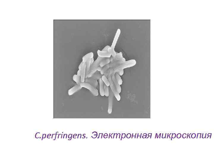 C. perfringens. Электронная микроскопия 