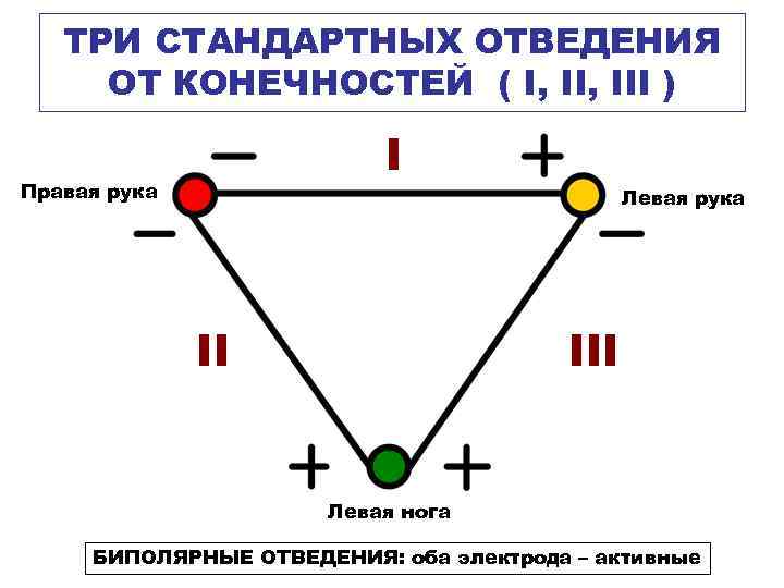 ТРИ СТАНДАРТНЫХ ОТВЕДЕНИЯ ОТ КОНЕЧНОСТЕЙ ( I, III ) I Правая рука Левая рука