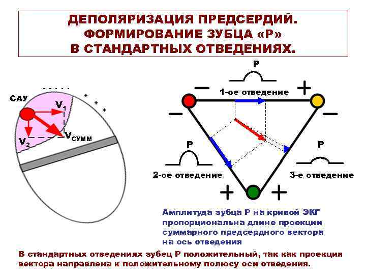 ДЕПОЛЯРИЗАЦИЯ ПРЕДСЕРДИЙ. ФОРМИРОВАНИЕ ЗУБЦА «Р» В СТАНДАРТНЫХ ОТВЕДЕНИЯХ. Р - - - САУ V