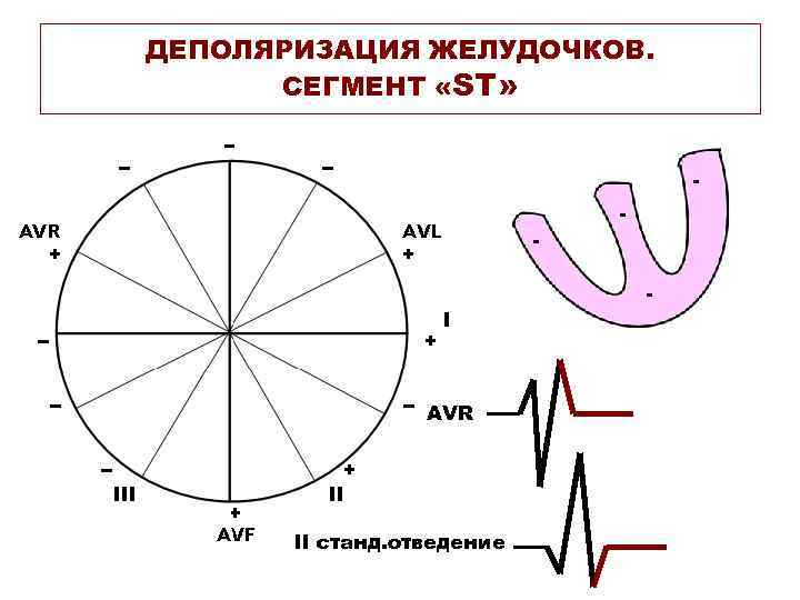 ДЕПОЛЯРИЗАЦИЯ ЖЕЛУДОЧКОВ. СЕГМЕНТ «ST» - - - AVR II станд. отведение 