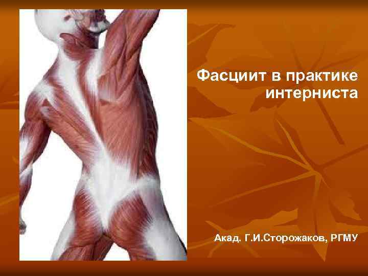 Фасциит в практике интерниста Акад. Г. И. Сторожаков, РГМУ 
