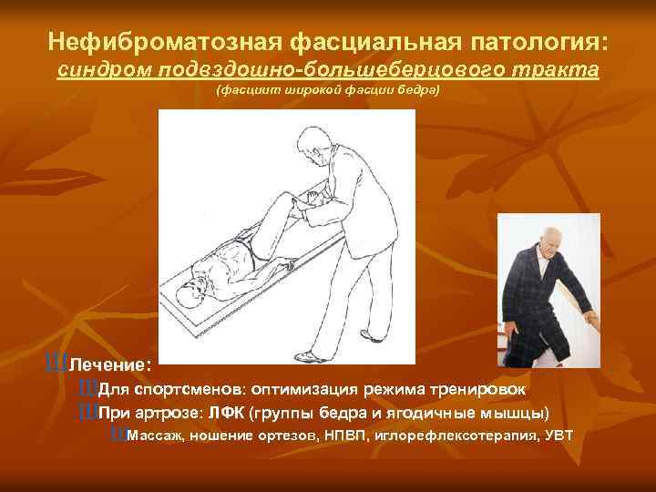 Нефиброматозная фасциальная патология: синдром подвздошно-большеберцового тракта (фасциит широкой фасции бедра) ШЛечение: ШДля спортсменов: оптимизация