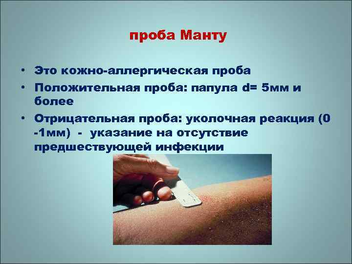 проба Манту • Это кожно-аллергическая проба • Положительная проба: папула d= 5 мм и