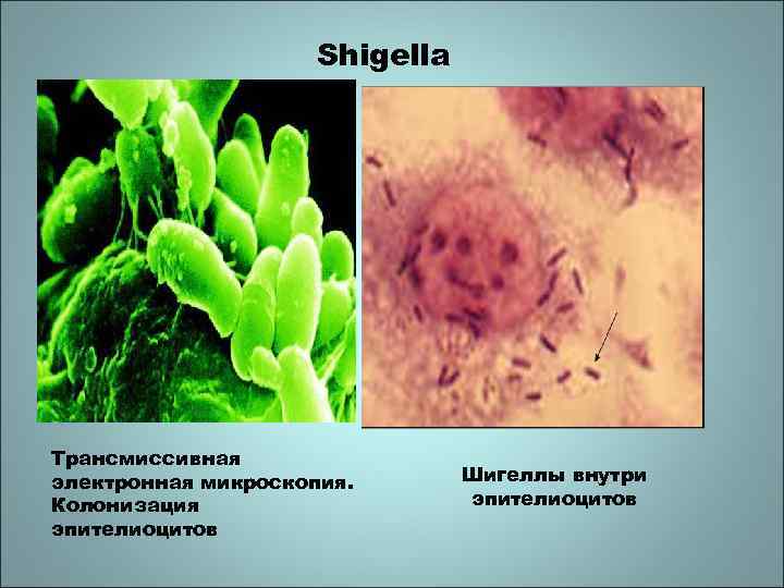 Shigella Трансмиссивная электронная микроскопия. Колонизация эпителиоцитов Шигеллы внутри эпителиоцитов 