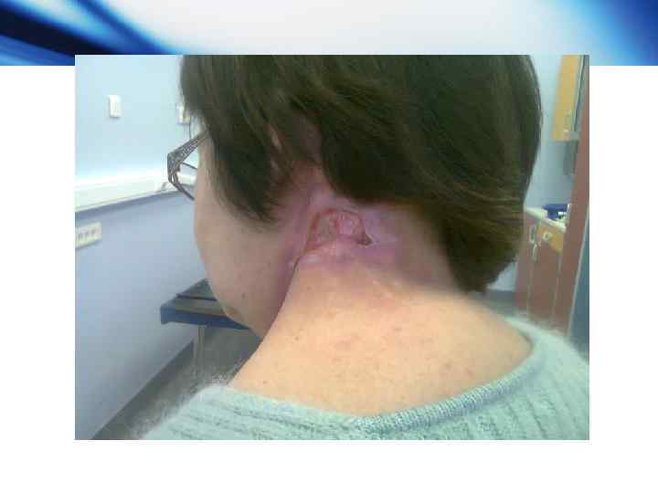  предлучевая подготовка для органов грудной клетки и верхнего этажа брюшной полости Контроль облучения