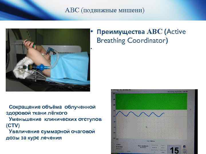  Технологический процесс KT (Toshiba Aquilon. LB®) Elekta Axesse® 2 Mosaiq® Elekta Axesse® 1
